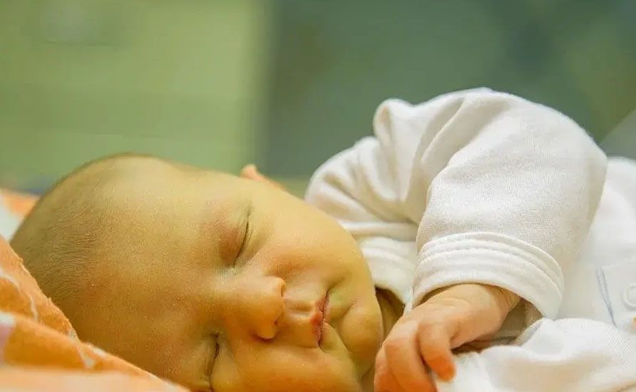 زردی نوزاد از چیست؟ دانستنی‌های ضروری برای والدین + درمان خانگی | فروشگاه فسقلی